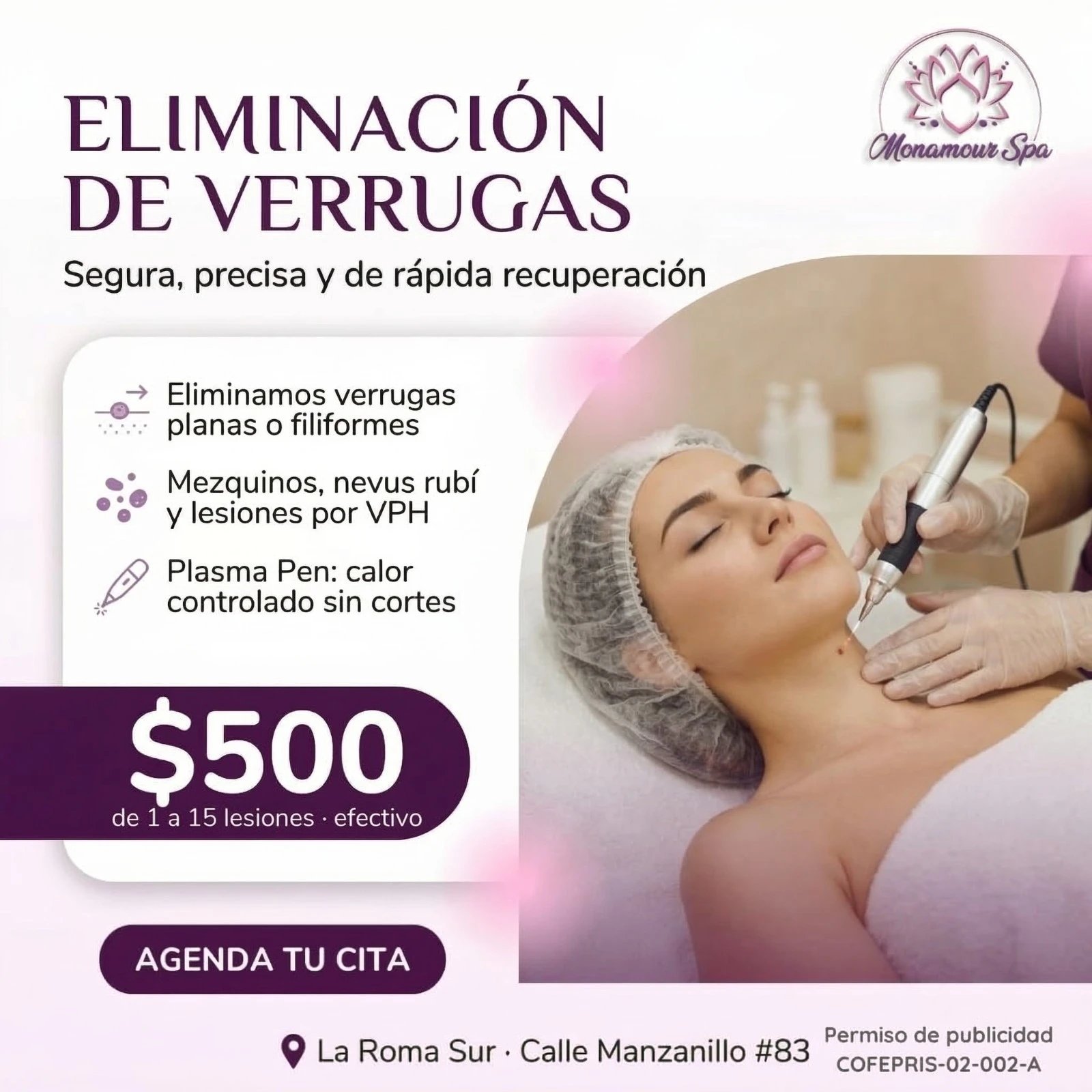 Eliminación de verrugas